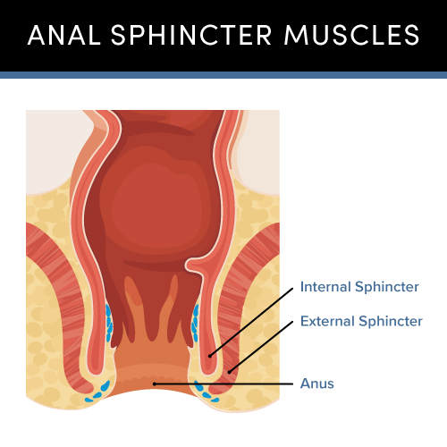 Graphic of the anal sphincter muscles