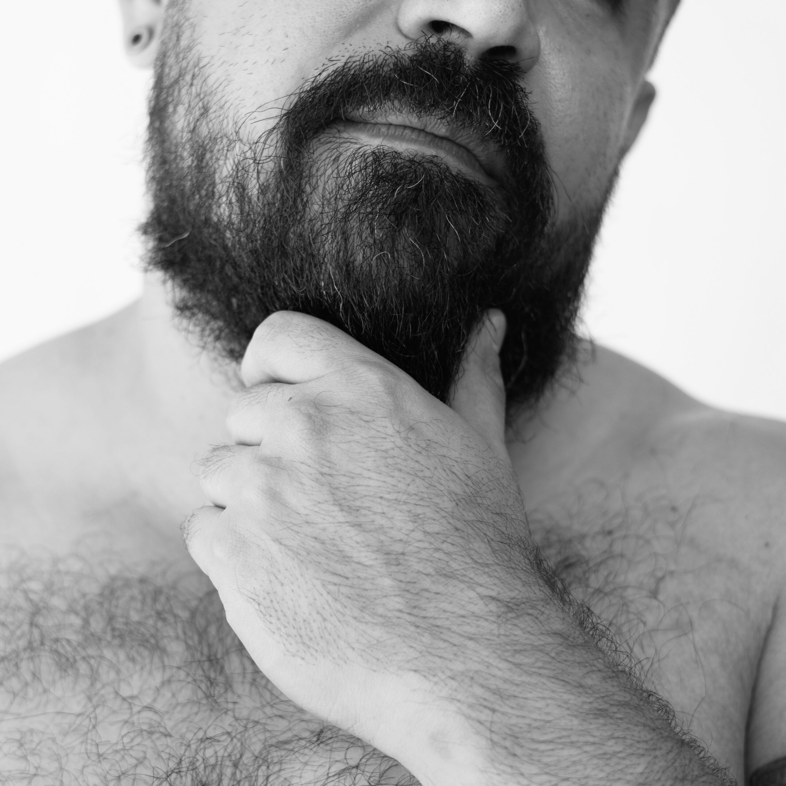 A man's beard shaped by laser hair removal